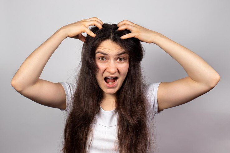 Want to get rid of head lice, try these home remedies