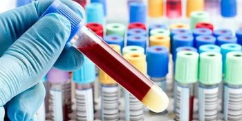 Case registered for wrong blood test report