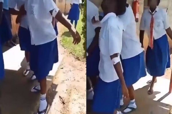 95 girl students of the school got paralyzed simultaneously, suddenly started limping and falling.